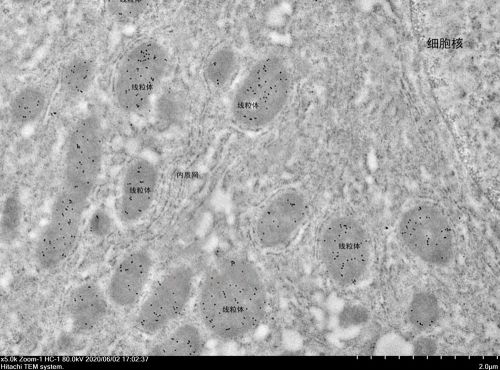 抗體費(免疫電鏡)