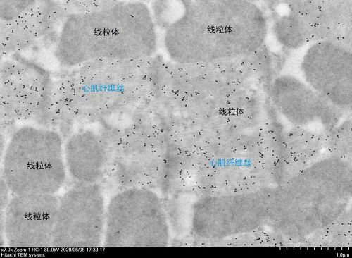 超薄切片(鎳網)
