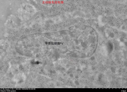 超薄切片(鎳網)