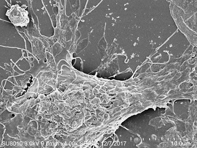 固定樣本SEM（脫水干燥噴金拍照）