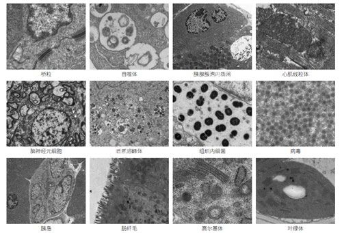 透射電鏡全套（包埋+制片+拍照）