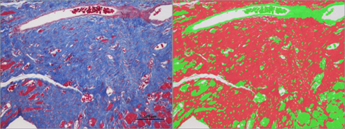 特染切片AI分析（面積）
