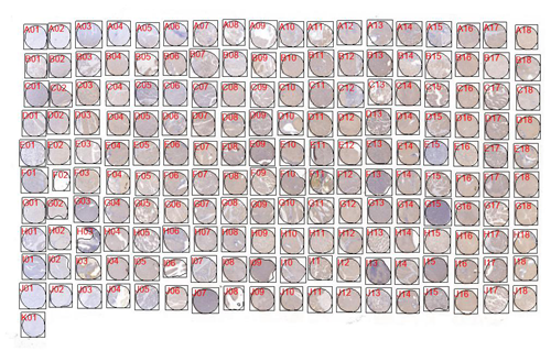 IHC芯片AI分析（面積）