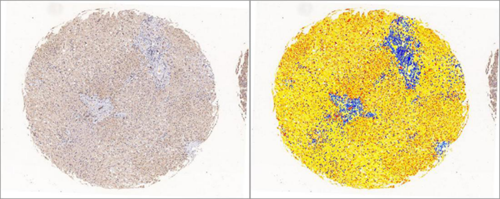 IHC芯片AI分析（面積）
