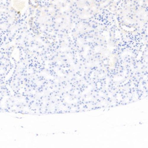 IHC切片AI分析（面積）