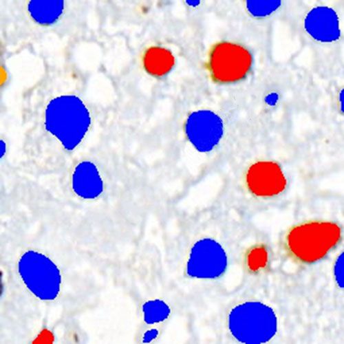 IHC切片AI分析（個數）