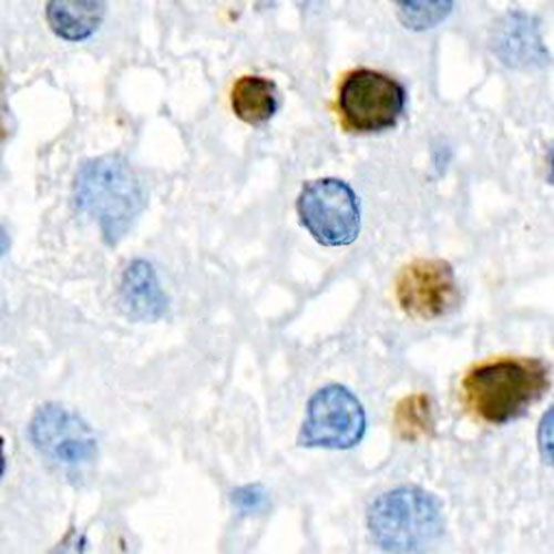 IHC切片AI分析（個數）