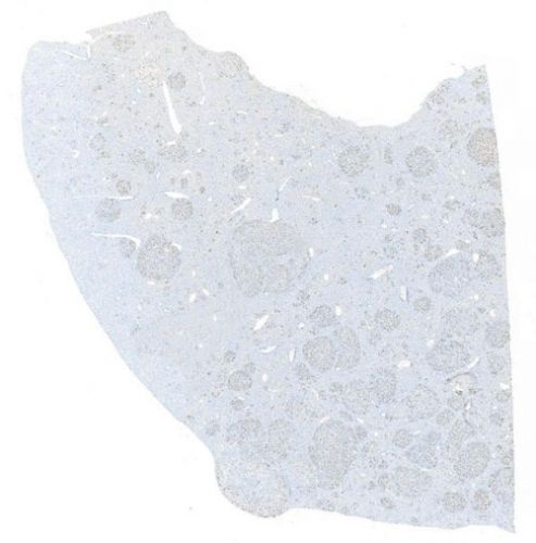 IHC切片AI分析（個數）