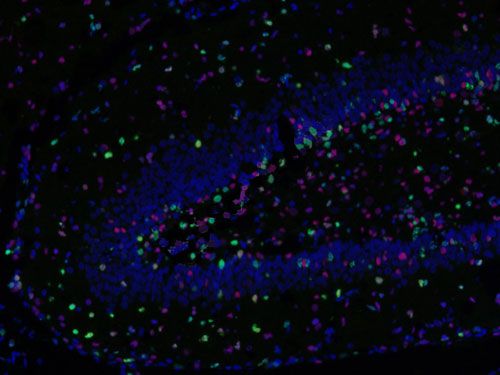 組化/熒光分析（拍照）