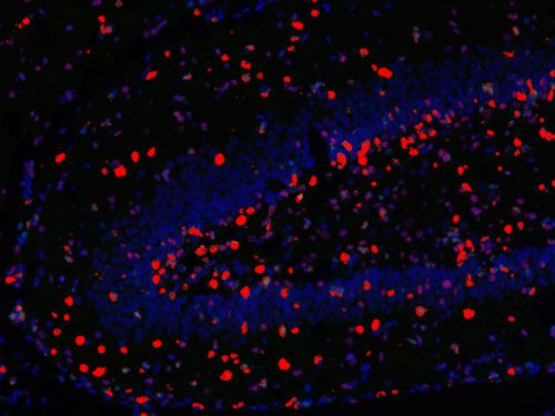組化/熒光分析（拍照）