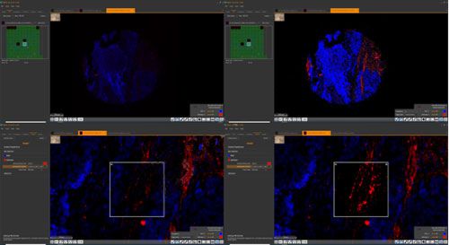 熒光分析（組織芯片數字掃描）