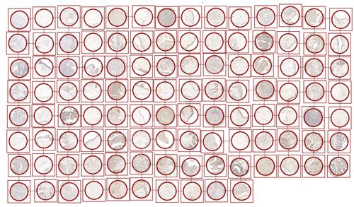 組化分析（組織芯片數字掃描）