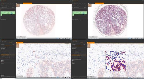 組化分析（組織芯片數字掃描）