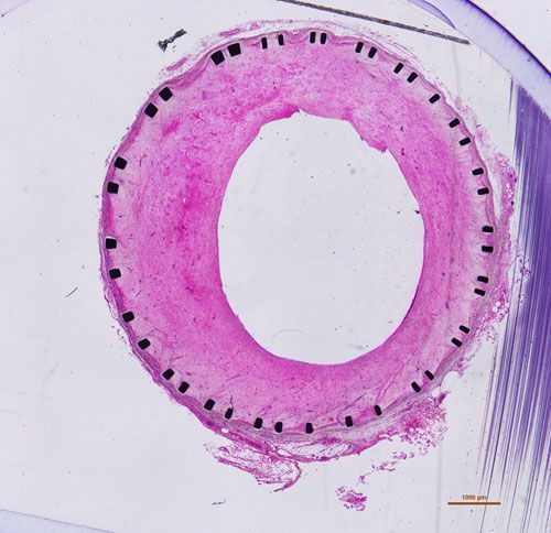 拍照（圖像拼接）