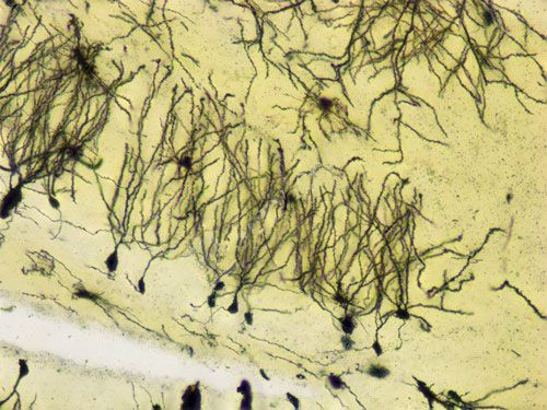 拍照（景深擴(kuò)展）