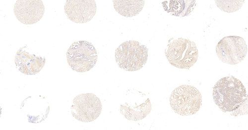 原位雜交（組織芯片）