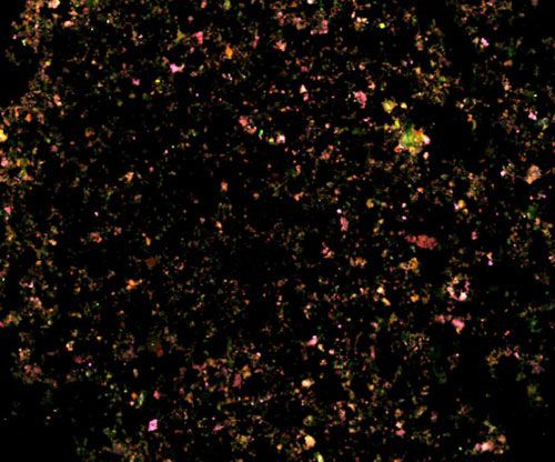 原位雜交（FISH三標(biāo)）