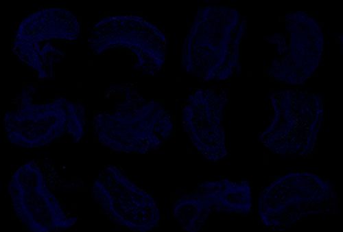 TUNEL（組織芯片）檢測(cè)