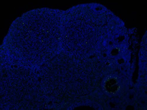 TUNEL（熒光）檢測