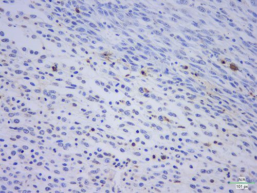 TUNEL（白光）檢測