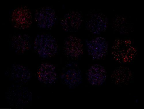 免疫熒光（單標(biāo)，組織芯片）