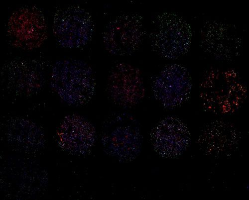 免疫熒光（雙標(biāo)，組織芯片）