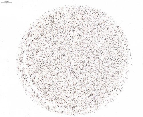 細胞芯片ICC檢測+掃描分析