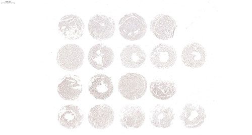 細胞芯片ICC檢測+掃描分析