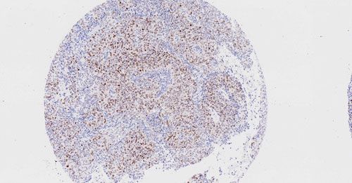 免疫組化（組織芯片）