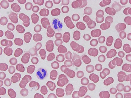 瑞氏姬姆薩染色