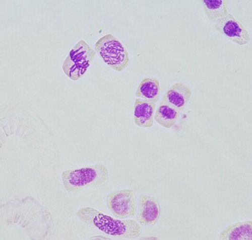 改良苯酚品紅染色