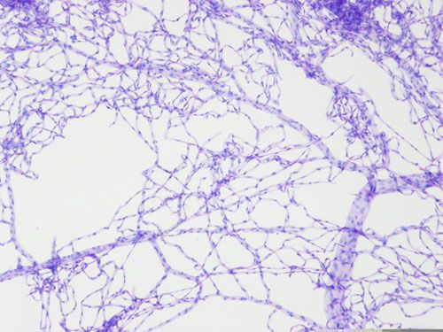 視網膜血管網鋪片PAS染色