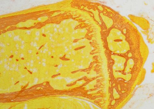 未脫鈣骨天狼猩紅染色