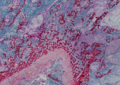 未脫鈣骨番紅固綠染色