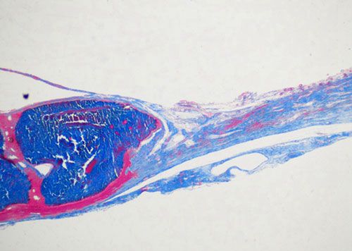 未脫鈣骨Masson染色