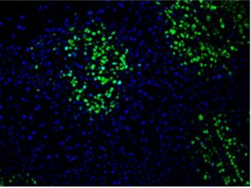 TUNEL染色檢測(cè)細(xì)胞增殖