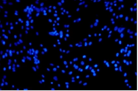 免疫熒光技術(shù)原理與常見(jiàn)問(wèn)題解析