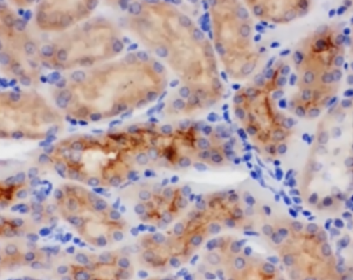 免疫組化IHC染色實驗結(jié)果解讀